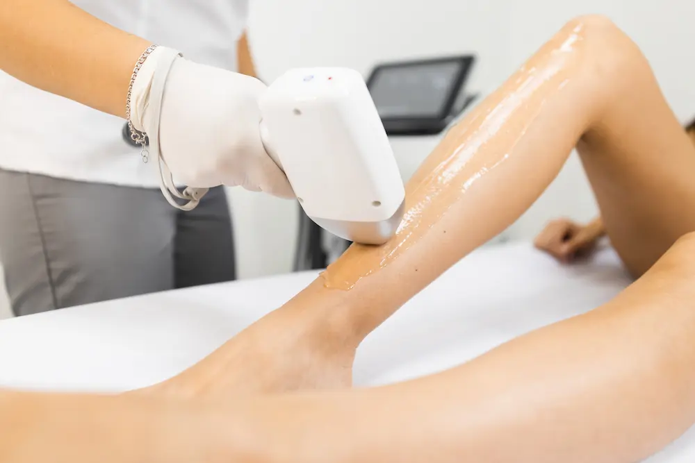 laser-hair-removal-process-for-woman-s-legs-2022-01-10-21-23-15-utc (1)